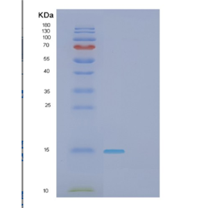 Recombinant Human GAGE2A Protein,Recombinant Human GAGE2A Protein