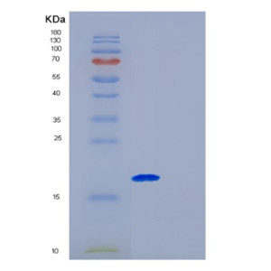 Recombinant Human Galectin9 Protein,Recombinant Human Galectin9 Protein