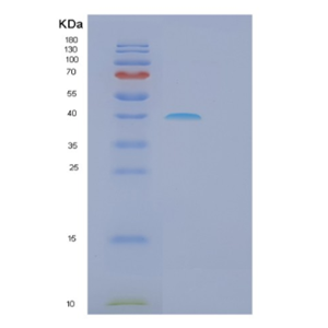 Recombinant Human GALE Protein