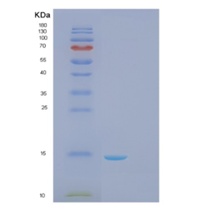 Recombinant Human Galectin-1 Protein,Recombinant Human Galectin-1 Protein