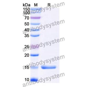 抗 Clostridium botulinum botA/BOTOX 納米抗體 (SAA0924)(RXX00904),Anti-Clostridium botulinum botA/BOTOX Nanobody (SAA0924)