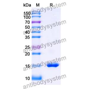 抗 SARS-CoV-2 S Protein 納米抗體 (SAA1058)(RVV00148),Anti-SARS-CoV-2 S Protein Nanobody (SAA1058)