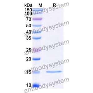 抗 Clostridium botulinum botA/BOTOX 納米抗體 (SAA0925)(RXX00905),Anti-Clostridium botulinum botA/BOTOX Nanobody (SAA0925)