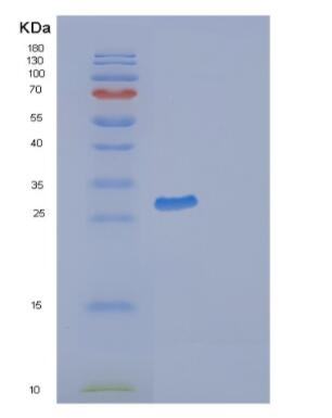 Recombinant Human GAP43 Protein,Recombinant Human GAP43 Protein