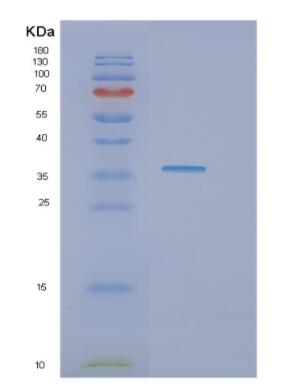 Recombinant Human GAPDH Protein,Recombinant Human GAPDH Protein