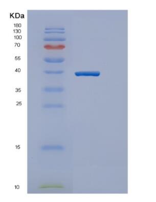 Recombinant Mouse Gapth Protein,Recombinant Mouse Gapth Protein