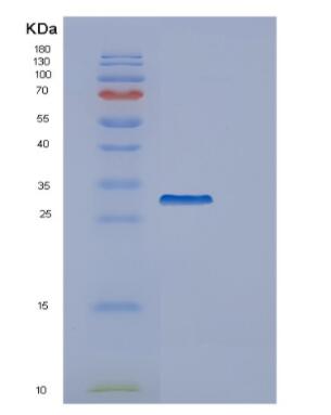 Recombinant Human GARS Protein,Recombinant Human GARS Protein