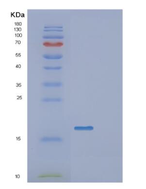 Recombinant Human GATC Protein,Recombinant Human GATC Protein