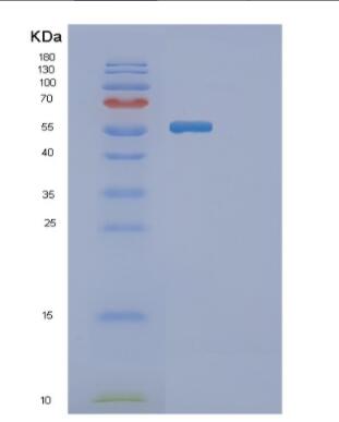 Recombinant Human GBA Protein,Recombinant Human GBA Protein