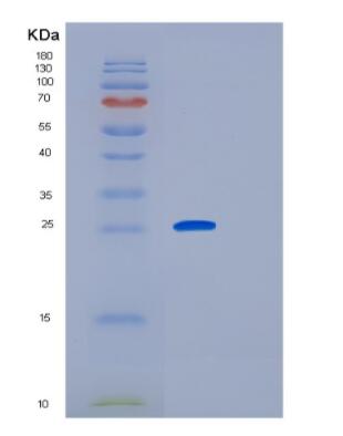 Recombinant Human GCA Protein,Recombinant Human GCA Protein