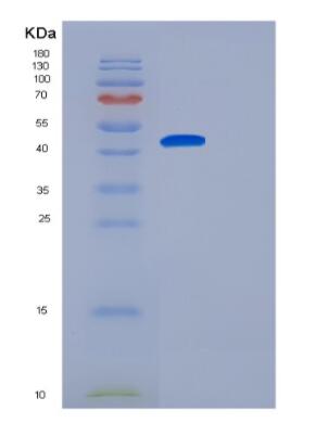 Recombinant Human GCAT Protein,Recombinant Human GCAT Protein