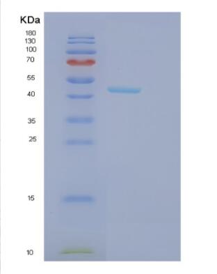 Recombinant Human GCDH Protein,Recombinant Human GCDH Protein