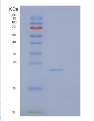 Recombinant Human GCET2 Protein,Recombinant Human GCET2 Protein