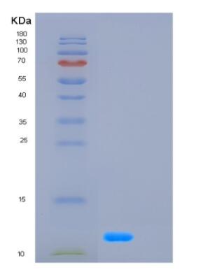 Recombinant Human GCG Protein,Recombinant Human GCG Protein