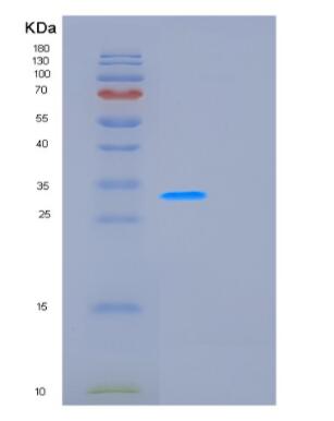 Recombinant Human GCLM Protein,Recombinant Human GCLM Protein