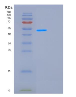 Recombinant Human GCN5L2 Protein,Recombinant Human GCN5L2 Protein