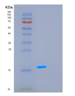 Recombinant Human GCSH Protein,Recombinant Human GCSH Protein