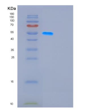 Recombinant Human GDA Protein,Recombinant Human GDA Protein