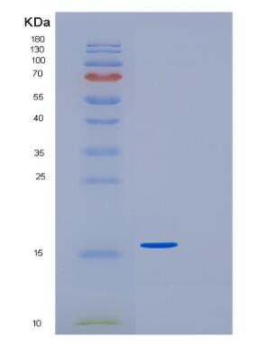 Recombinant Human GDF-15 Protein,Recombinant Human GDF-15 Protein