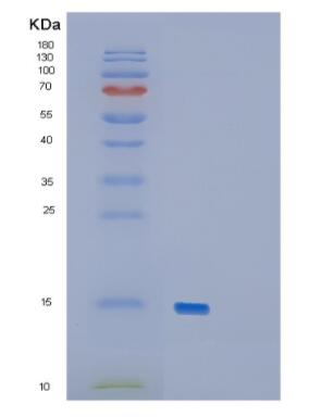 Recombinant Mouse GDF15 Protein,Recombinant Mouse GDF15 Protein