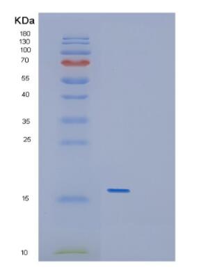 Recombinant Mouse GDF5 Protein,Recombinant Mouse GDF5 Protein