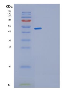 Recombinant Human GDI1 Protein,Recombinant Human GDI1 Protein