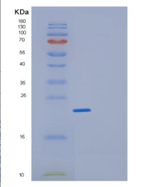 Recombinant Human GEMIN6 Protein,Recombinant Human GEMIN6 Protein