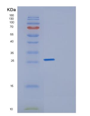 Recombinant Human Geminin Protein,Recombinant Human Geminin Protein