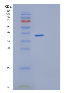 Recombinant Human GET4 Protein,Recombinant Human GET4 Protein