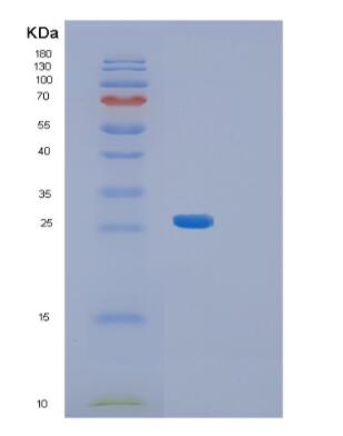 Recombinant Human Aequorea victoriaGFP Protein,Recombinant Human Aequorea victoriaGFP Protein