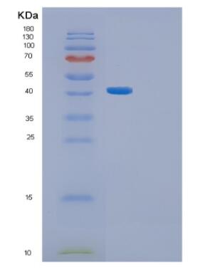 Recombinant Human GFPT1 Protein,Recombinant Human GFPT1 Protein