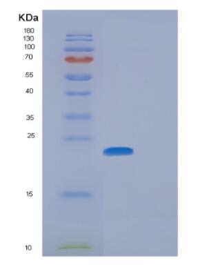 Recombinant Human GGCT Protein,Recombinant Human GGCT Protein