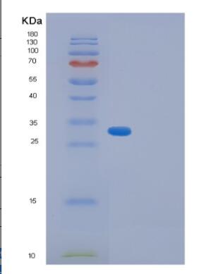 Recombinant Human GID8 Protein,Recombinant Human GID8 Protein