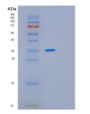 Recombinant Human GIMAP6 Protein,Recombinant Human GIMAP6 Protein