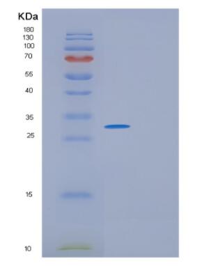 Recombinant Human GINS4 Protein,Recombinant Human GINS4 Protein