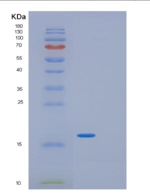 Recombinant Human GIP Protein,Recombinant Human GIP Protein