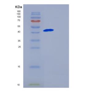 Recombinant Human GALK1 Protein