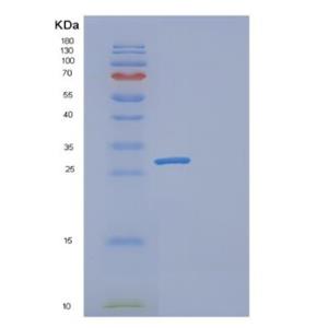 Recombinant Human GAMT Protein