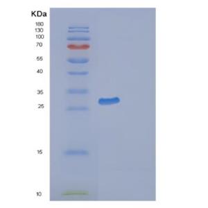 Recombinant Human GAP43 Protein