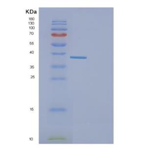 Recombinant Mouse GAPDH Proteina