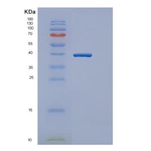 Recombinant Mouse Gapth Protein,Recombinant Mouse Gapth Protein