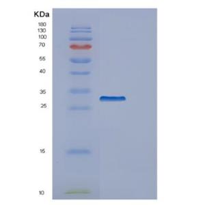 Recombinant Human GARS Protein