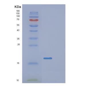 Recombinant Human GATC Protein,Recombinant Human GATC Protein