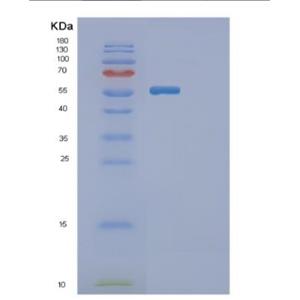 Recombinant Human GBA Protein,Recombinant Human GBA Protein