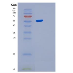 Recombinant Human GBA3 Protein