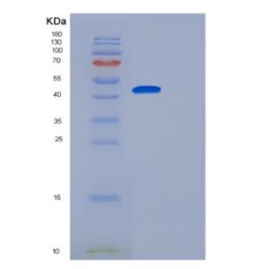 Recombinant Human GCAT Protein,Recombinant Human GCAT Protein