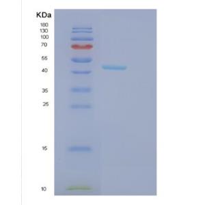 Recombinant Human GCDH Protein,Recombinant Human GCDH Protein