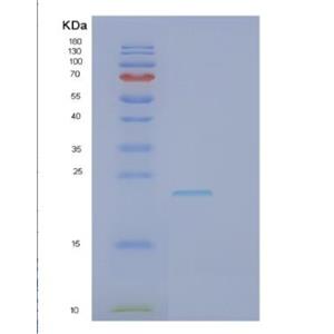 Recombinant Human GCET2 Protein,Recombinant Human GCET2 Protein