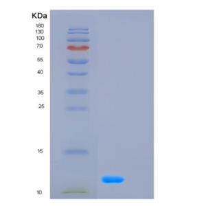 Recombinant Human GCG Protein,Recombinant Human GCG Protein