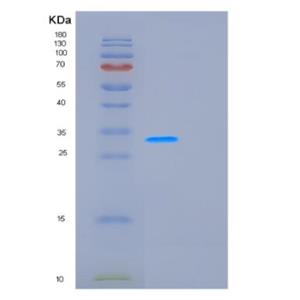 Recombinant Human GCLM Protein,Recombinant Human GCLM Protein